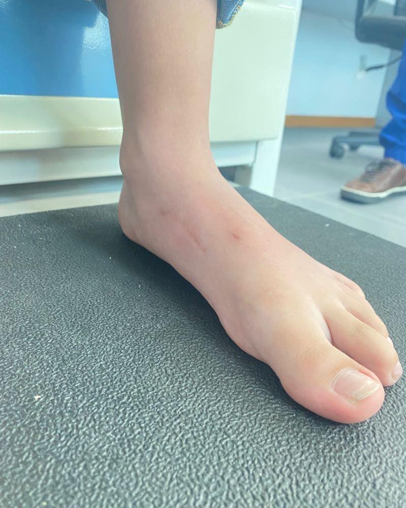 pie plano limitacion 5