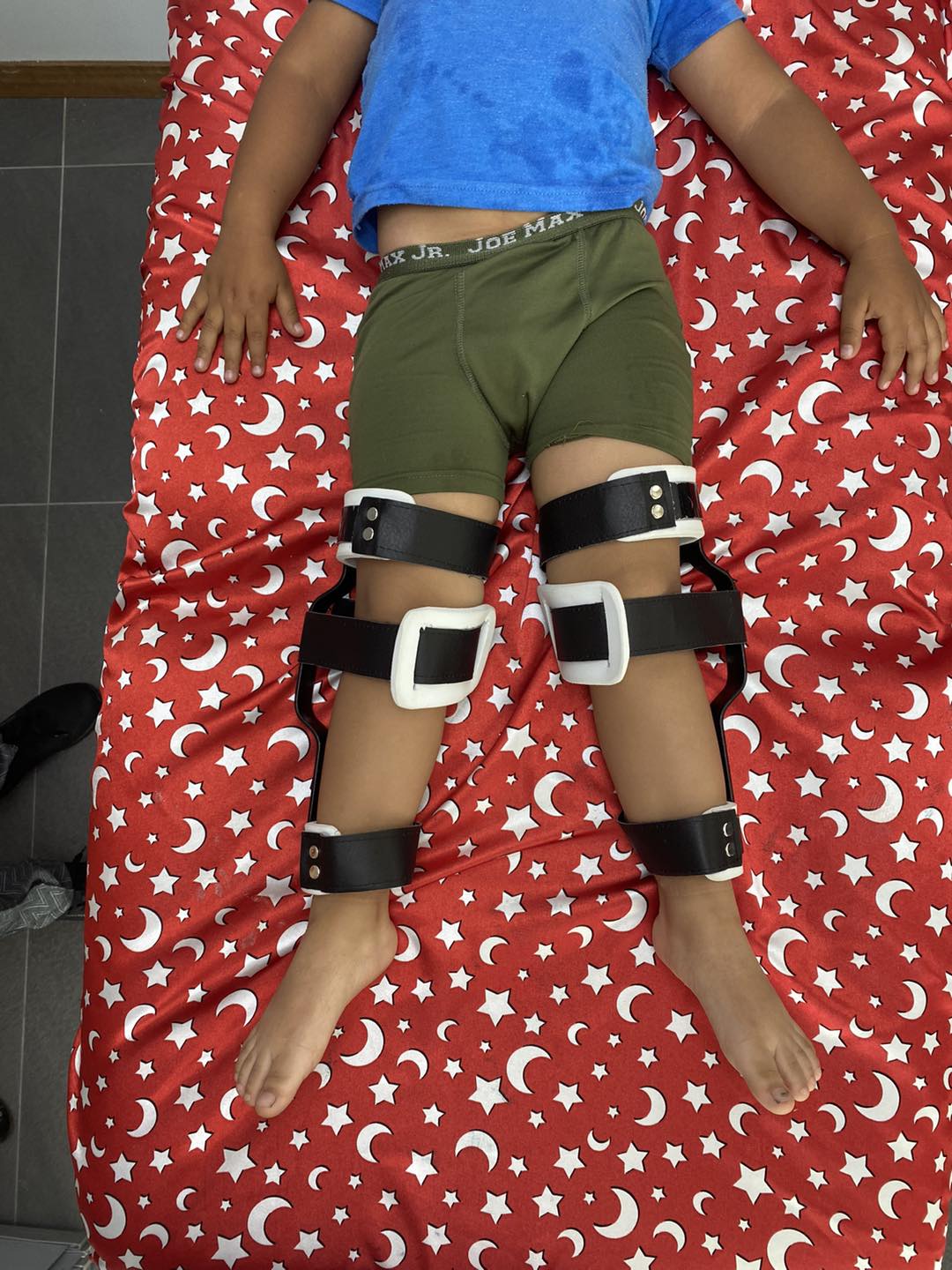 pie plano limitacion 2