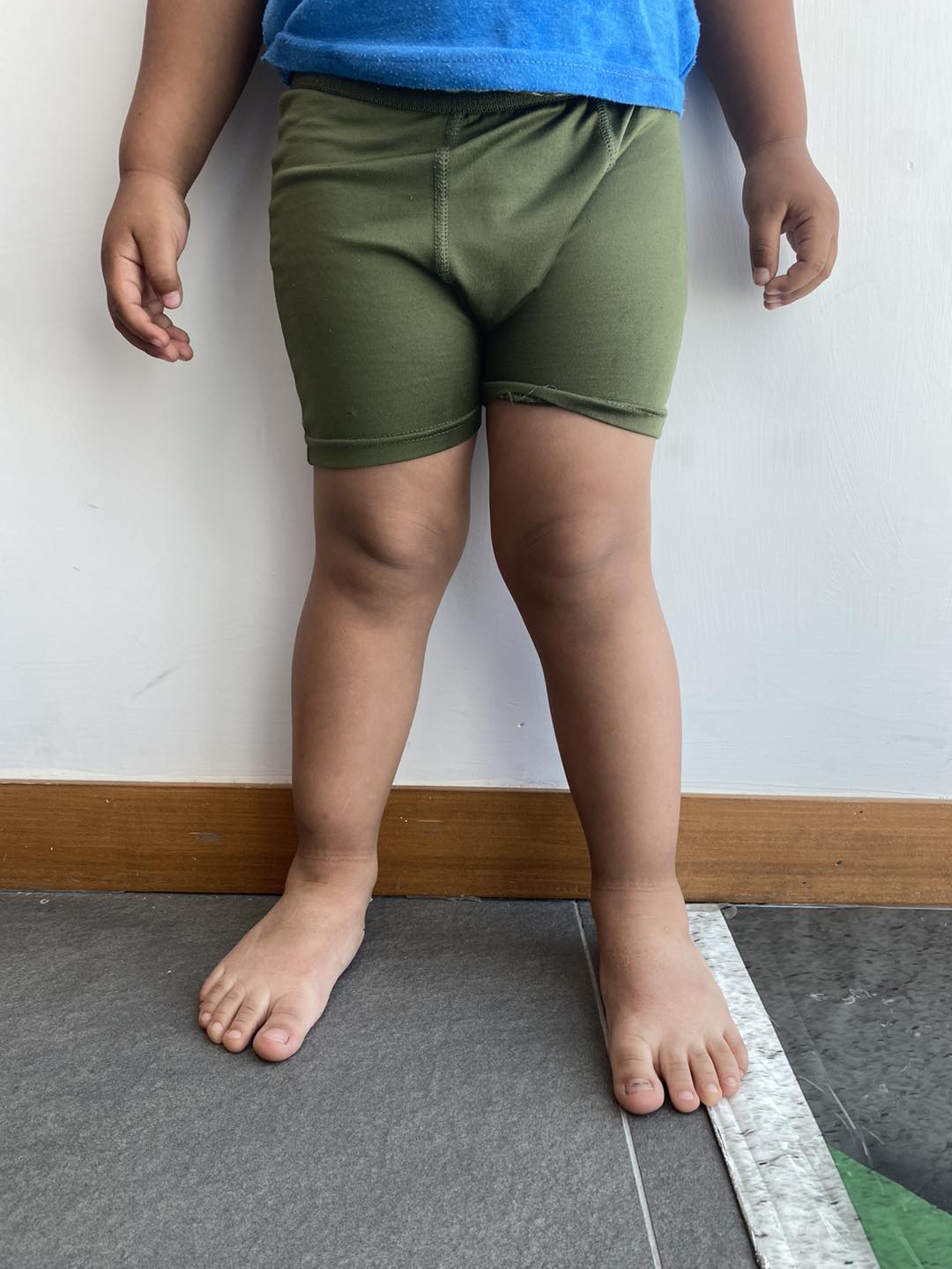 pie plano limitacion 3