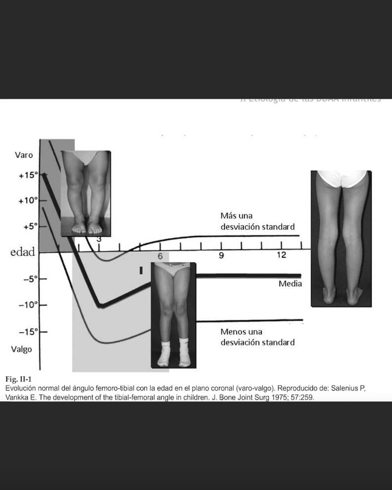pie plano limitacion 7