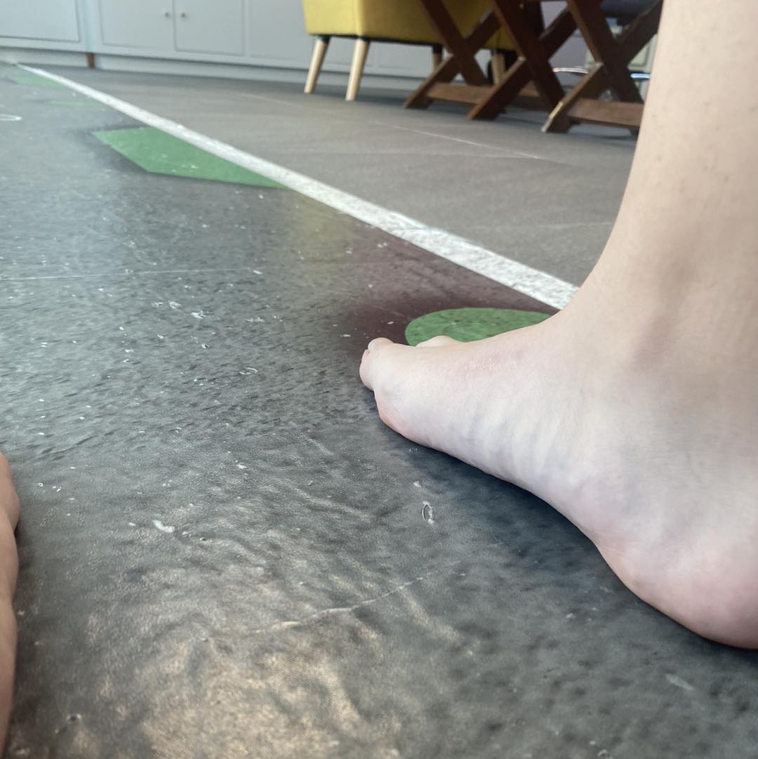 pies planos dolorosos 4