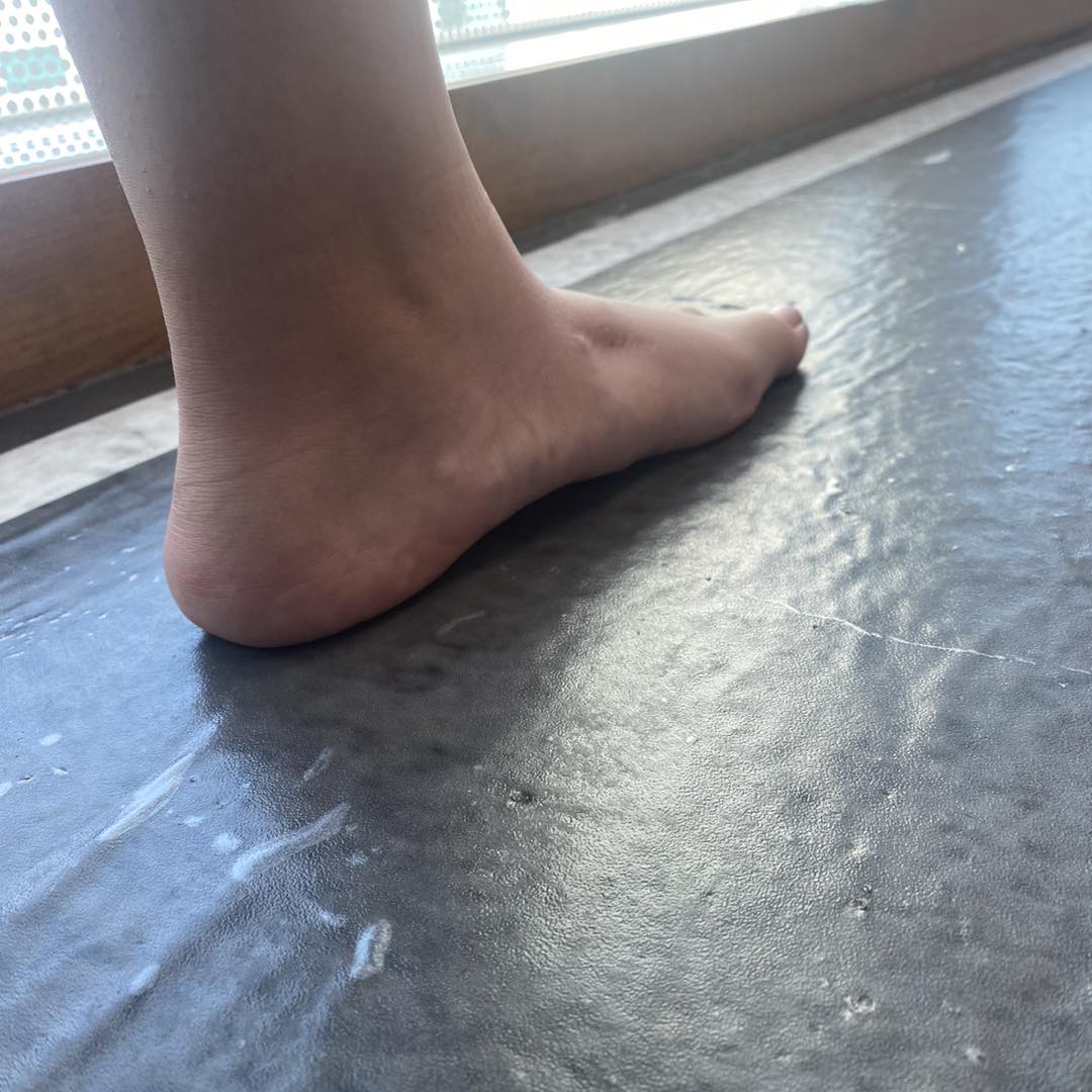 pies planos dolorosos 5
